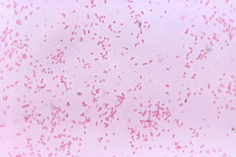 Bacteria