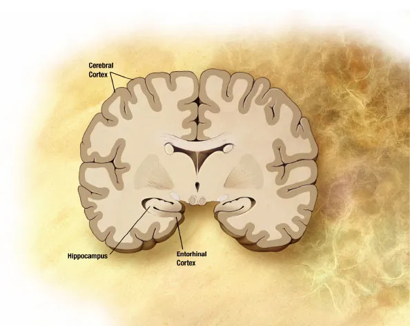 relatively normal brain