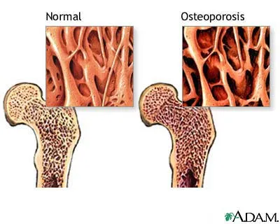 Internal Bone Structure
