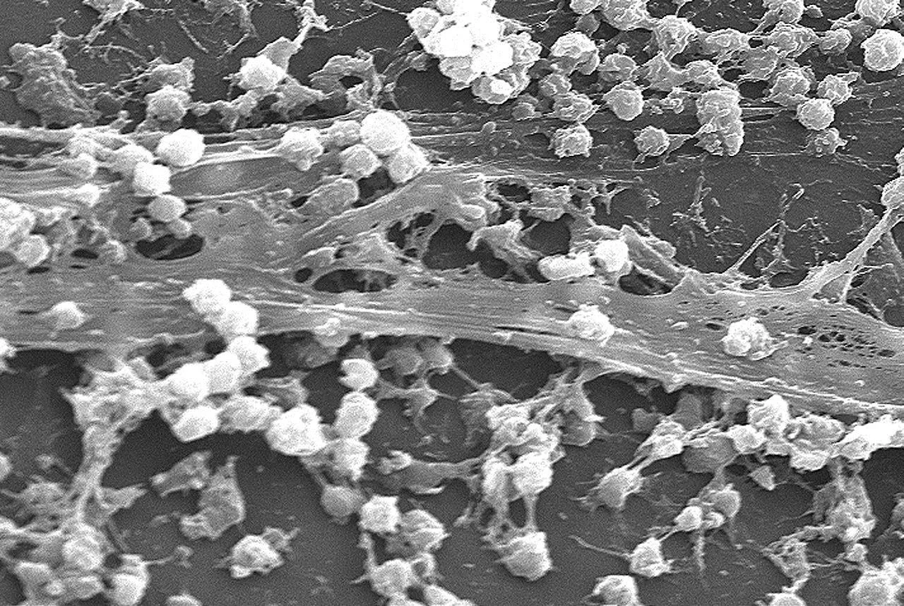 Staphylococcus
