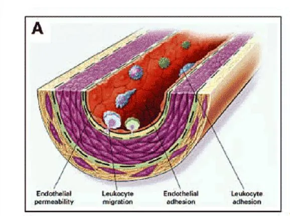 artery cross section