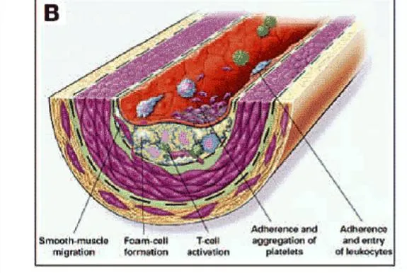 heightened micro-inflamation